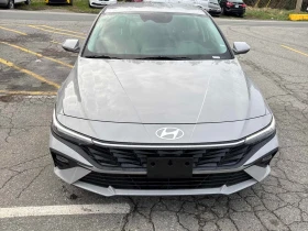 Hyundai Elantra * Preferred * CARFAX * БЕЗ ПЪРВОНАЧАЛНА ВНОСКА - 35900 лв. / 18355.38 € - 49939165 6 | Car24.bg Hyundai Elantra * Preferred * CARFAX * БЕЗ ПЪРВОНАЧАЛНА ВНОСКА - 35900 лв. / 18355.38 € - 49939165 6