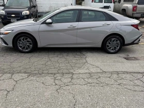 Hyundai Elantra * Preferred * CARFAX * БЕЗ ПЪРВОНАЧАЛНА ВНОСКА - 35900 лв. / 18355.38 € - 49939165 2 | Car24.bg Hyundai Elantra * Preferred * CARFAX * БЕЗ ПЪРВОНАЧАЛНА ВНОСКА - 35900 лв. / 18355.38 € - 49939165 2