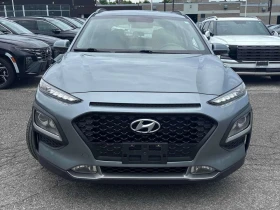 Hyundai Kona * Preferred * АВТОКРЕДИТ БЕЗ ПЪРВОНАЧАЛНА ВНОСКА* | Auto.bg — изображение 6 Hyundai Kona * Preferred * АВТОКРЕДИТ БЕЗ ПЪРВОНАЧАЛНА ВНОСКА* | Auto.bg — изображение 6