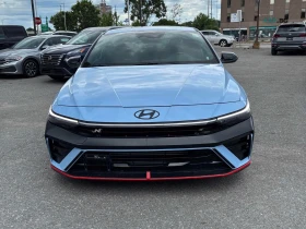 Hyundai Elantra N ЦЕНА ДО БЪЛГАРИЯ РЕГИСТРАЦИЯ & АВТОКРЕДИТ | Auto.bg — изображение 2 Hyundai Elantra N ЦЕНА ДО БЪЛГАРИЯ РЕГИСТРАЦИЯ & АВТОКРЕДИТ | Auto.bg — изображение 2