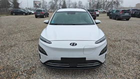 Hyundai Kona СЪДЕЙСТВИЕ ЗА ПРОВЕРКА НА СЪСТ В СЕРВИЗ НА HYUNDAI - 18300 € / 35791.69 лв. - 92986532 3