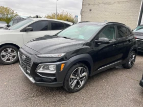 Hyundai Kona * Ultimate * CARFAX * БЕЗ ПЪРВОНАЧАЛНА ВНОСКА - 39050 лв. / 19965.95 € - 30571875 2
