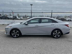 Hyundai Elantra * CARFAX * БЕЗ ПЪРВОНАЧАЛНА ВНОСКА - 40000 лв. / 20451.68 € - 11399933 3