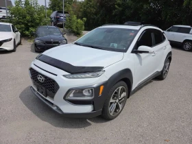 Hyundai Kona Ultimate | АВТОКРЕДИТ БЕЗ ПЪРВОНАЧАЛНА ВНОСКА | 