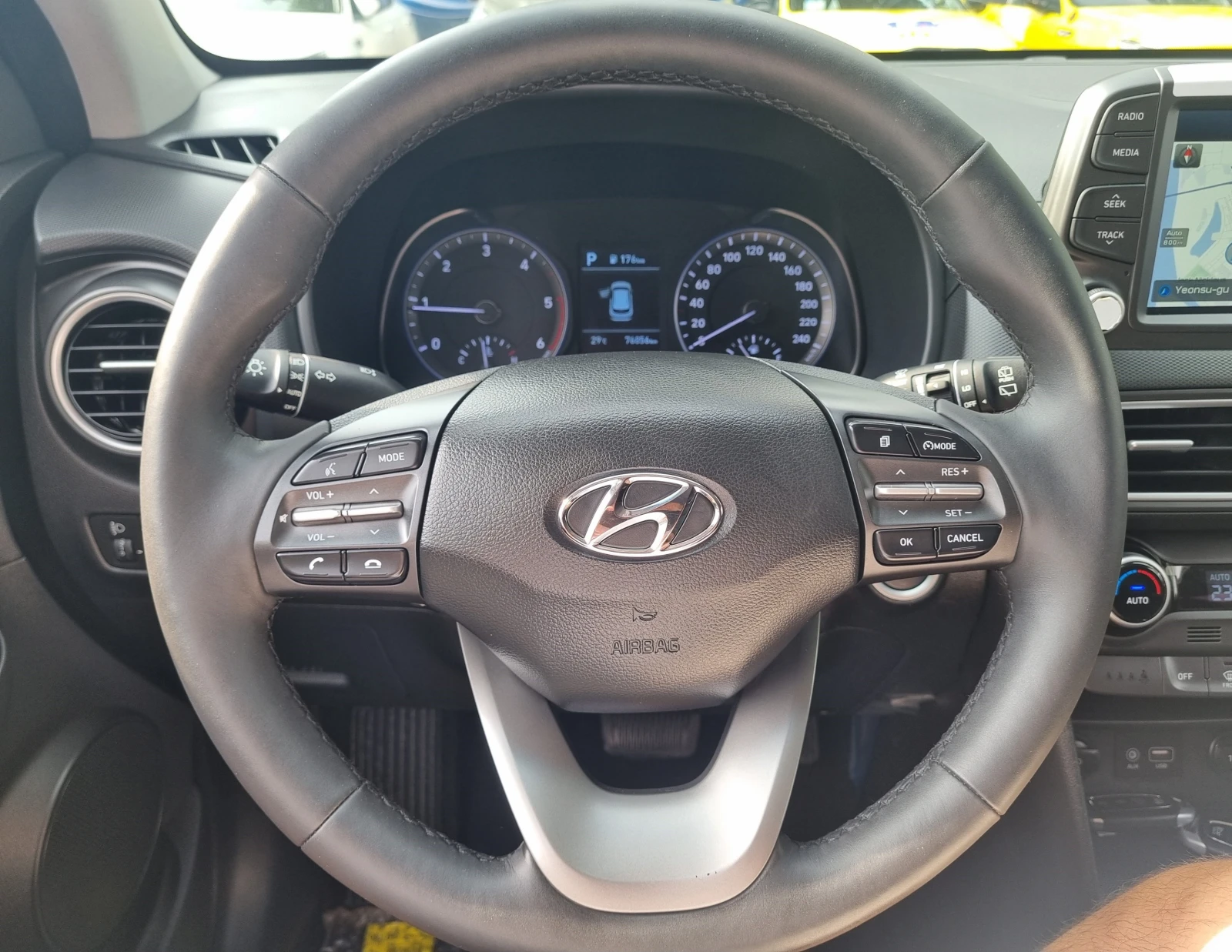 Hyundai Kona 1.6 CRDI - изображение 10