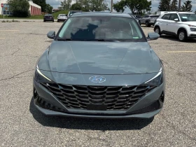 Hyundai Elantra * Ultimate * CARFAX * БЕЗ ПЪРВОНАЧАЛНА ВНОСКА, снимка 6
