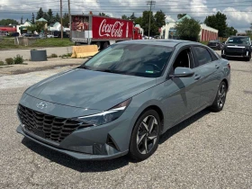 Hyundai Elantra * Ultimate * CARFAX * БЕЗ ПЪРВОНАЧАЛНА ВНОСКА, снимка 1