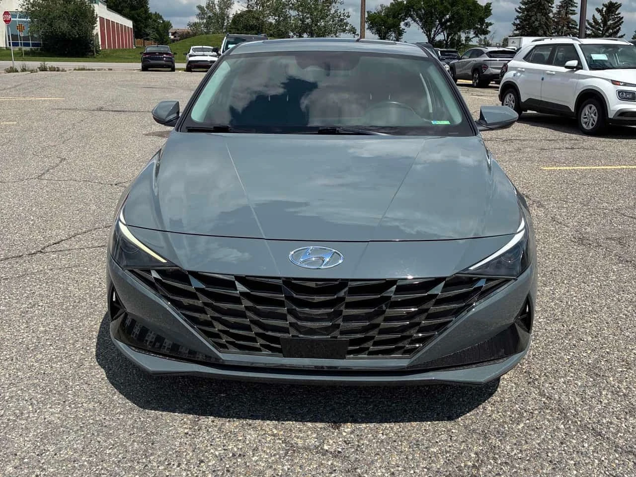 Hyundai Elantra * Ultimate * CARFAX * БЕЗ ПЪРВОНАЧАЛНА ВНОСКА, снимка 6 - Автомобили и джипове - 55143241