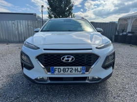 Обява за продажба на Hyundai Kona 1.6CRDI / 136 ps / FULL EXTRI / 117 хил км / 2019г ~29 900 лв. - изображение 1