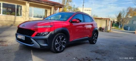 Hyundai Kona - 58500 лв. / 29910.58 € - 22565063 11